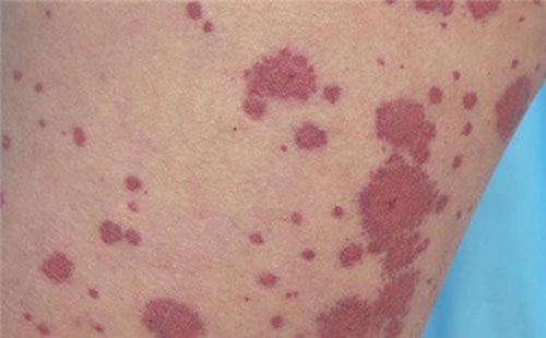 �����������ô���� ����Ӧע��ʲô